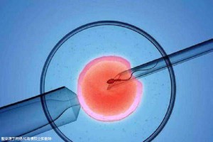 男性不育案例